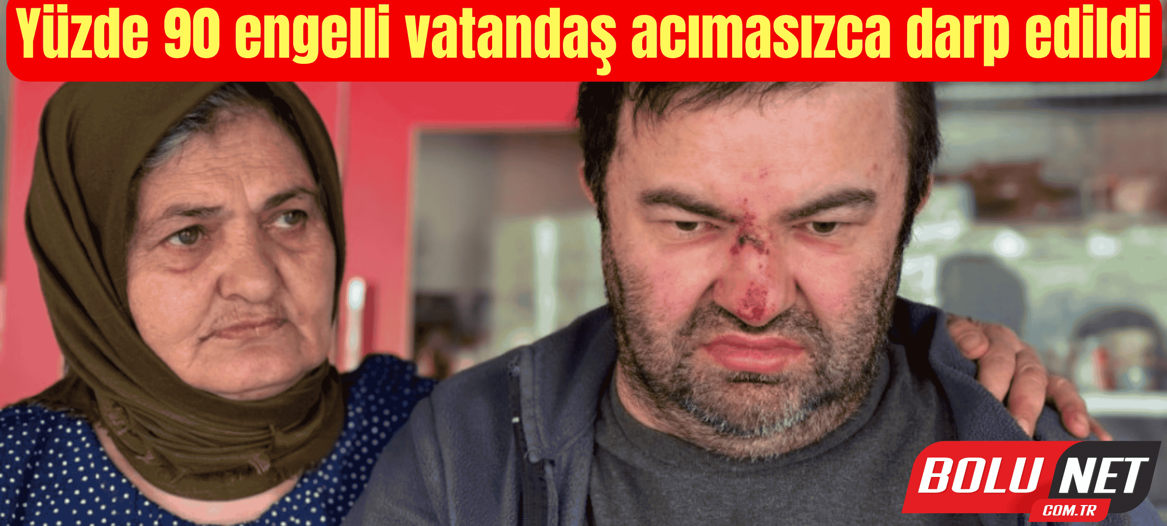 Yüzde 90 engelli vatandaş acımasızca darp edildi ...BoluNet
