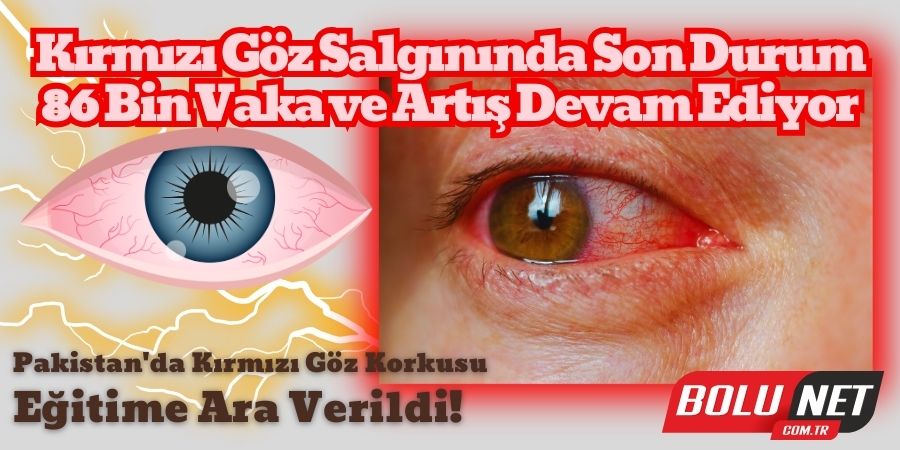 KIRMIZI GÖZ ALARMI: 86 Bin Vaka ve Artıyor!...BoluNet